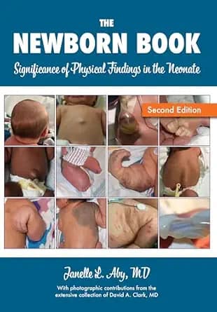 و دانلود نسخه کامل کتاب زبان اصلی The Newborn Book: Significance of Physical Findings in the Neonate PDF | دانلود کتاب خارجی