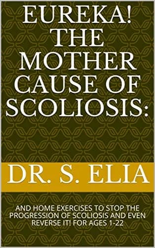 و دانلود نسخه کامل کتاب زبان اصلی EUREKA! THE MOTHER CAUSE OF SCOLIOSIS:: AND HOME EXERCISES TO STOP THE PROGRESSION OF SCOLIOSIS AND EVEN REVERSE IT! FOR AGES 1-22 Kindle Edition PDF | دانلود کت