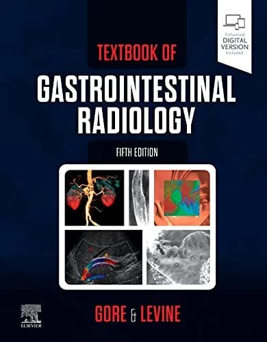 و دانلود نسخه کامل کتاب زبان اصلی Textbook of Gastrointestinal Radiology E-Book PDF | دانلود کتاب خارجی