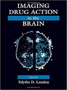 دانلود کتاب Imaging Drug Action in the Brain