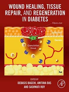 دانلود کتاب Wound Healing, Tissue Repair, and Regeneration in Diabetes