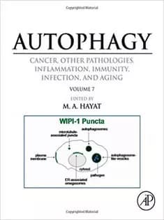 دانلود کتاب Autophagy: Cancer, Other Pathologies, Inflammation, Immunity, Infection, and Aging: Vol 7- Role of Autophagy in Thera