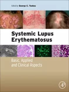 دانلود کتاب Systemic Lupus Erythematosus: Basic, Applied and Clinical Aspects