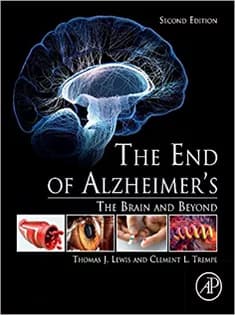 دانلود کتاب The End of Alzheimer’s : The Brain and Beyond