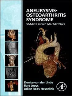 دانلود کتاب Aneurysms-Osteoarthritis Syndrome: SMAD3 Gene Mutations