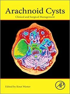 دانلود کتاب Arachnoid Cysts: Clinical and Surgical Management