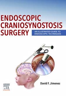 کتاب Endoscopic Craniosynostosis Surgery