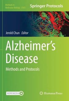 کتاب Alzheimer’s Disease