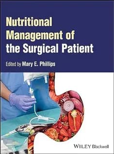 دانلود کتاب Nutritional Management of the Surgical Patient