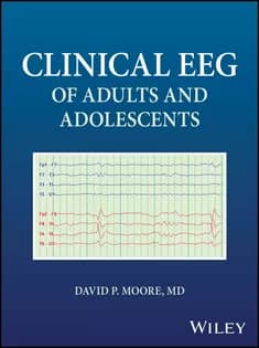دانلود کتاب Clinical EEG of Adults and Adolescents