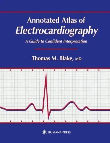 و دانلود نسخه کامل کتاب Annotated Atlas of Electrocardiography: A Guide to Confident Interpretation (Contemporary Cardiology Book 3) 1999th Edition