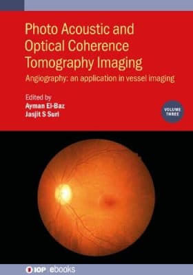 دانلود کتاب Photo Acoustic and Optical Coherence Tomography Imaging: Angiography: – An Application in Vessel Imaging