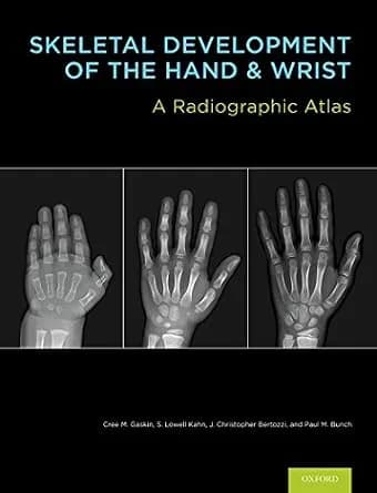 و دانلود نسخه کامل کتاب Skeletal Development of the Hand and Wrist: A Radiographic Atlas and Digital Bone Age Companion