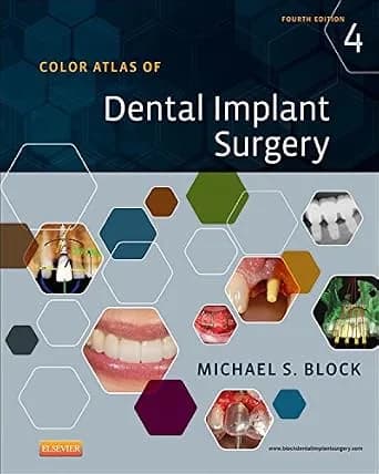 و دانلود نسخه کامل کتاب Color Atlas of Dental Implant Surgery – E-Book