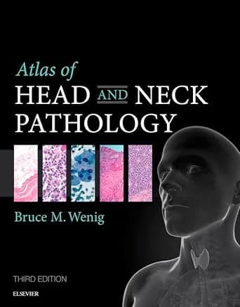 و دانلود نسخه کامل کتاب Atlas of Head and Neck Pathology (Atlas of Surgical Pathology)