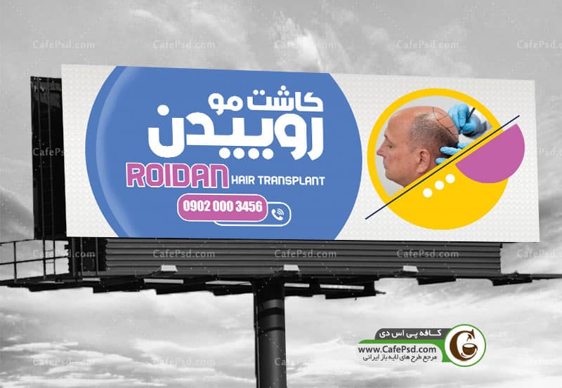 بنر مرکز کاشت مو