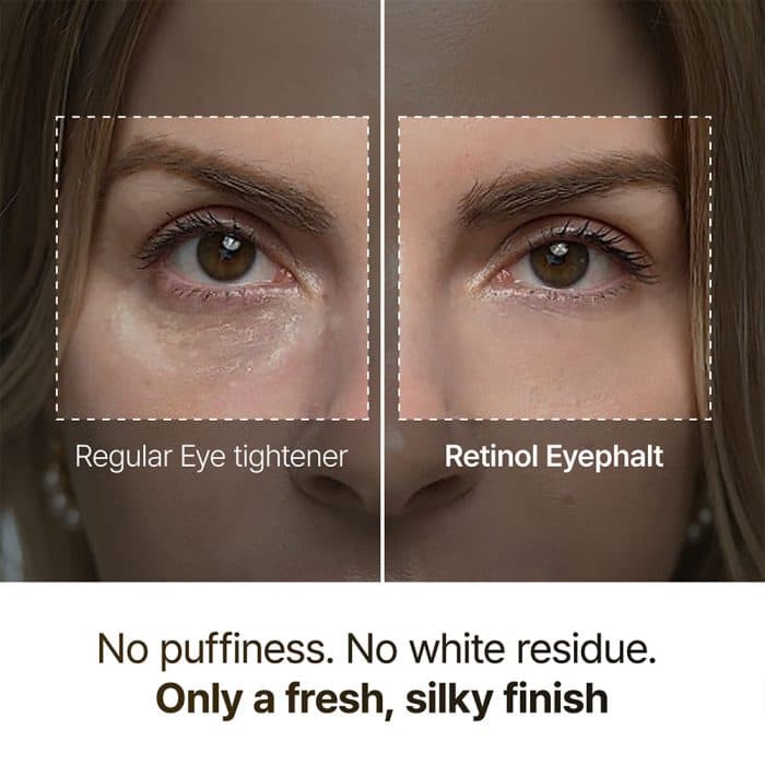 دور چشم رتینول دکتر ملاکسین Dr.Melaxin مدل Eyephalt Eyebag از بین برنده ی کیسه زیر چشمی, تیرگی و پف وزن 10 گرم — تصویر ۷