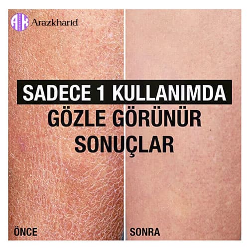 لوسیون بدن پوست خشک نوتروژینا با مرطوب کنندگی بالا Yoğun Nemlendirici حجم 400 میل — تصویر ۶