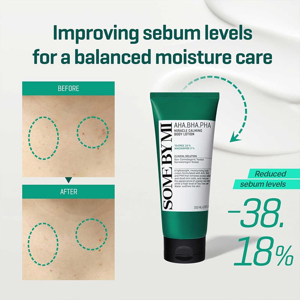 لوسیون بدن میراکل سام بای می ضدجوش، لایه بردار ملایم و تسکین دهنده پوست SOME BY MI AHA, BHA, PHA Miracle Calming Body Lotion — تصویر ۴