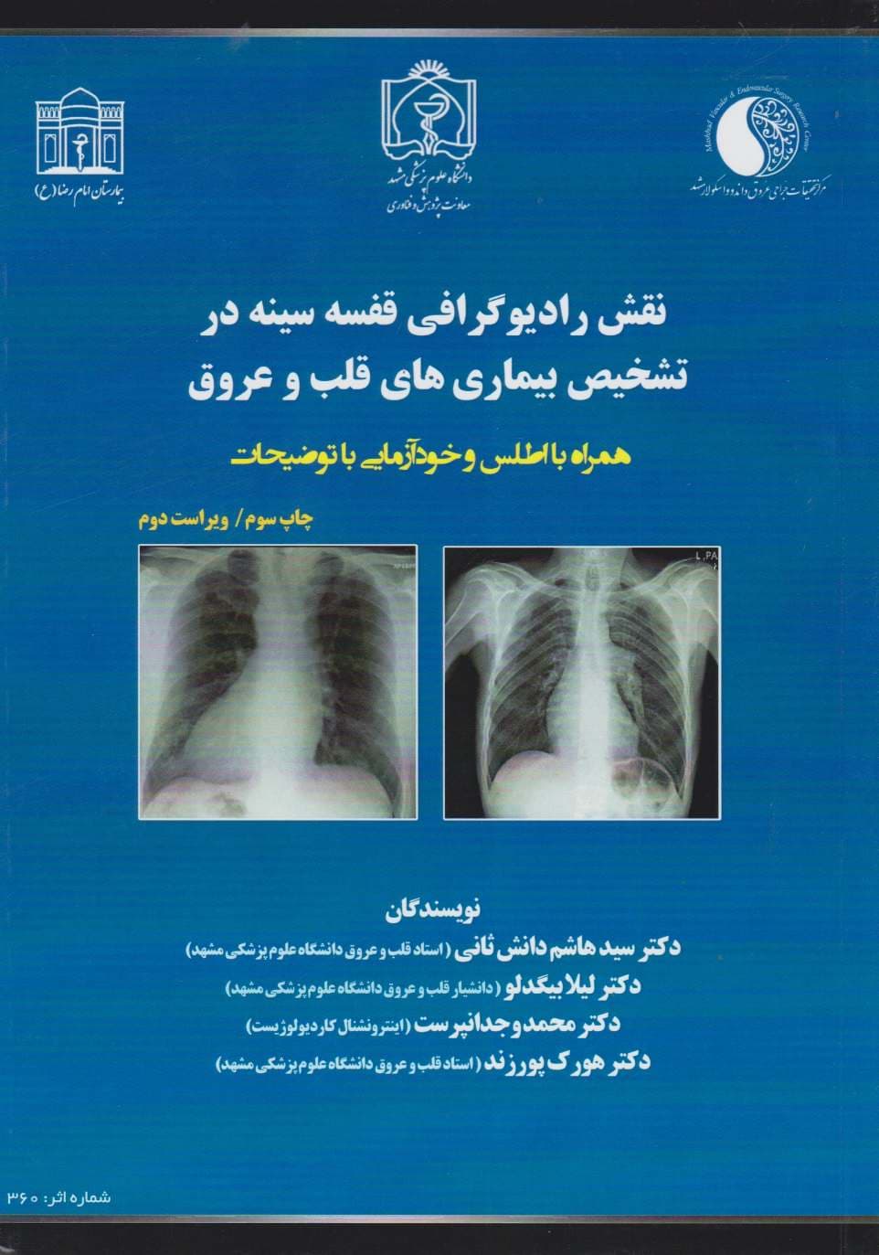 نقش رادیوگرافی قفسه سینه در تشخیص بیماری های قلب و عروق