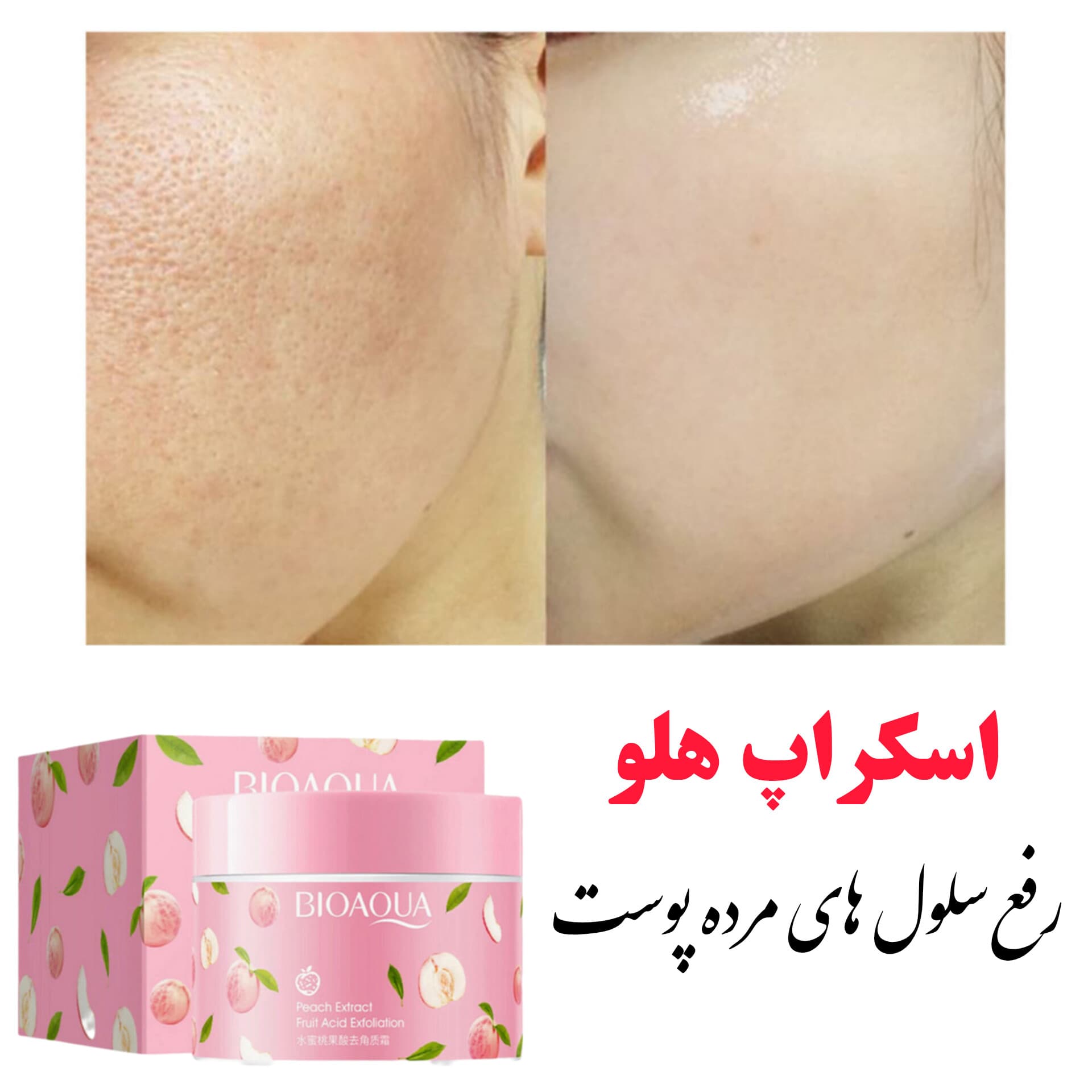 لایه بردار کره ای
