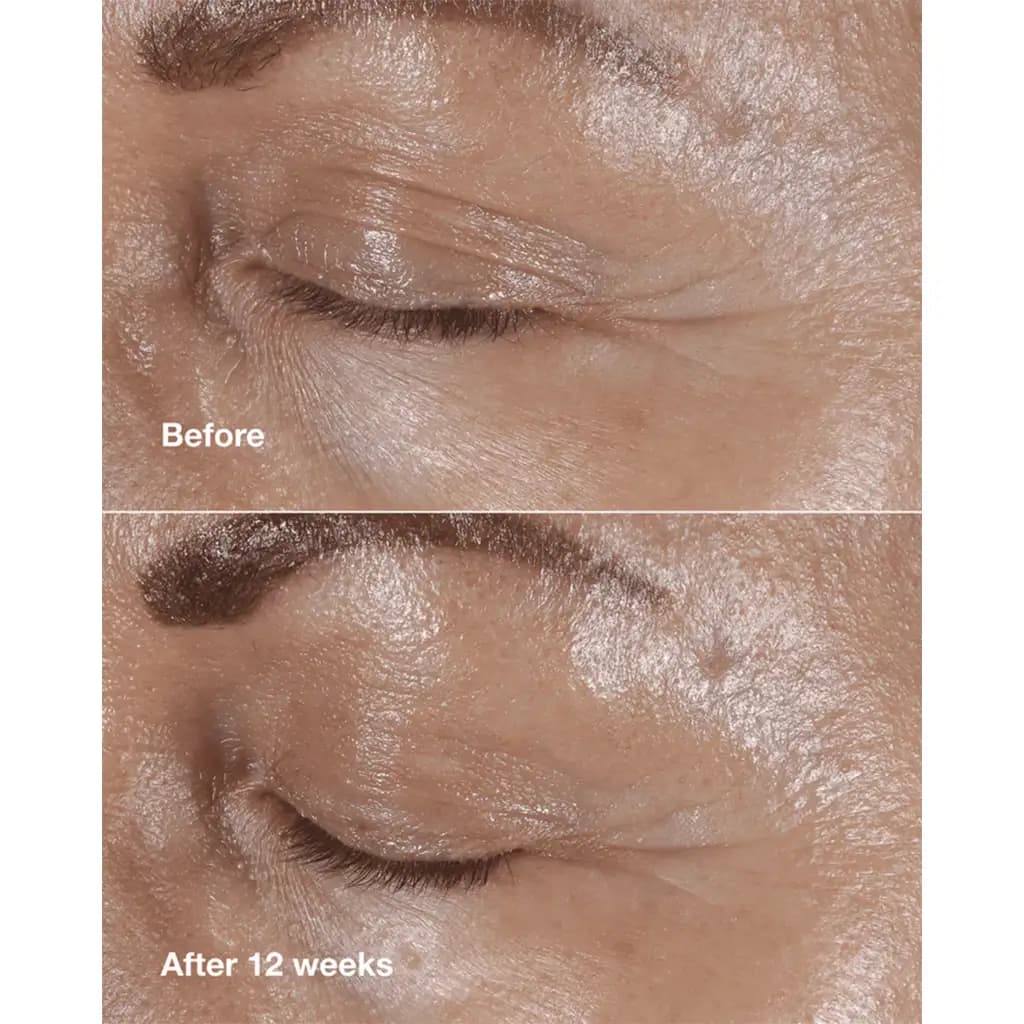 کرم ضد چروک دور چشم کلینیک مدل CLINIQUE smart clinical reapir eye cream — تصویر ۵