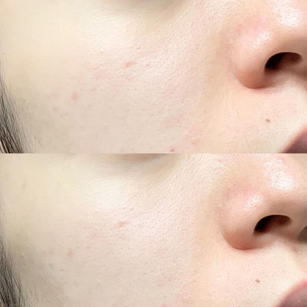 سرم کوچک کننده منافذ سوپرماچا سام بای می حجم 50 میل — تصویر ۷
