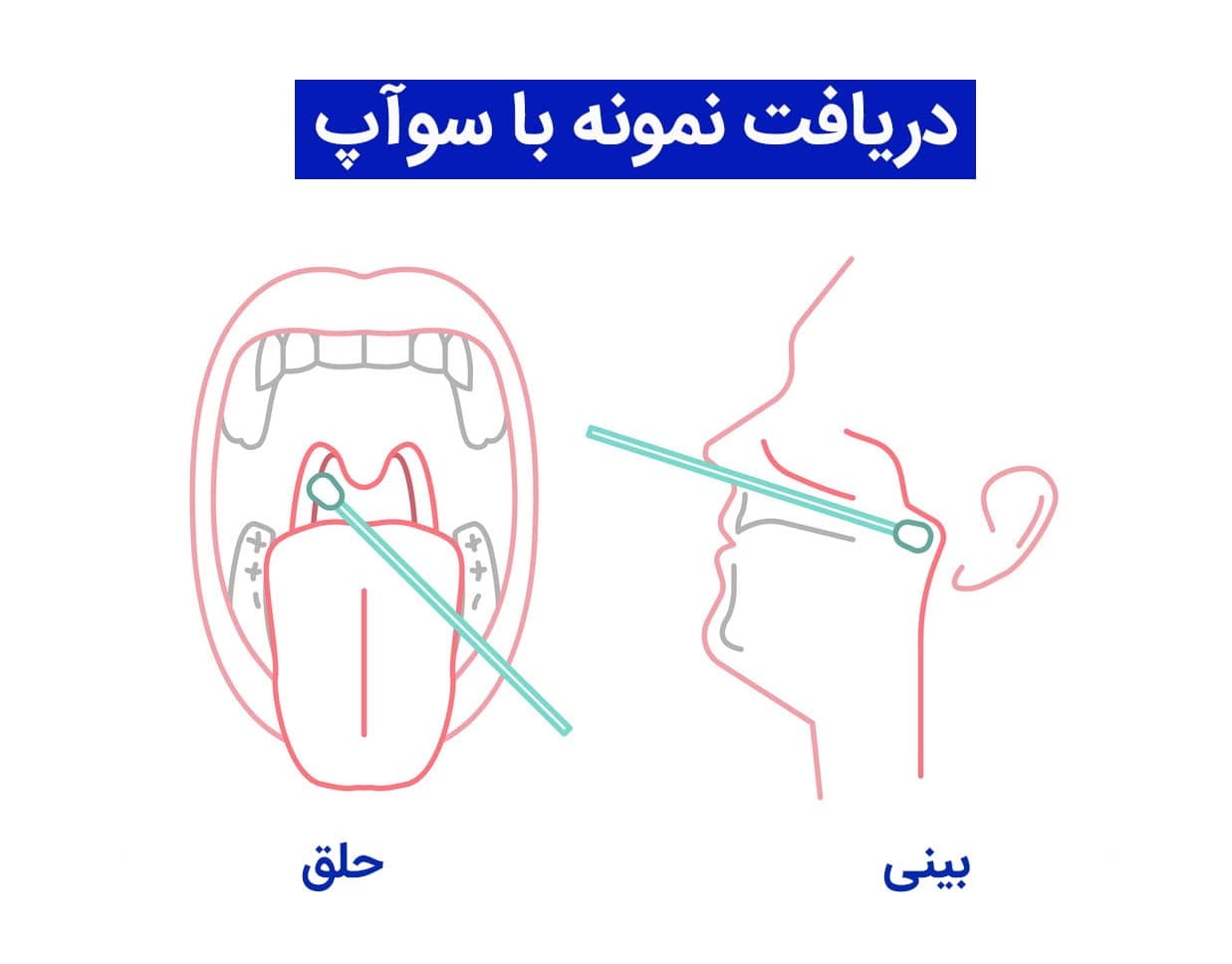 رپید تست حلقی کرونا -آنتی ژن — تصویر ۳