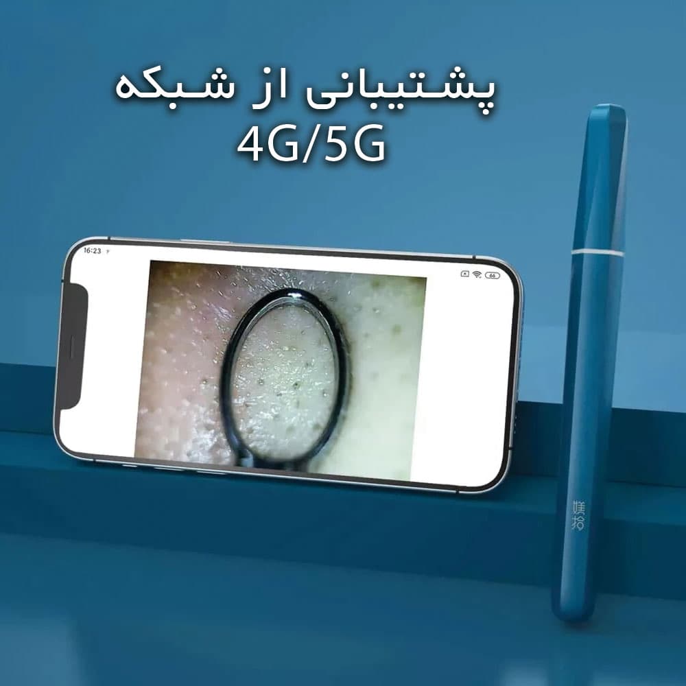 دستگاه پاک کننده صورت Wisdom WiFi Smart Pore Cleaner شیائومی — تصویر ۱۱
