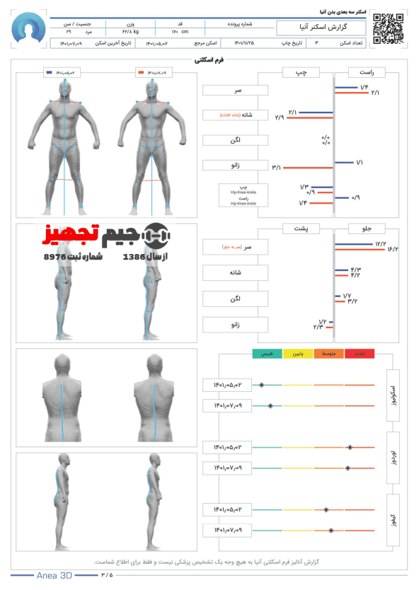 اسکنر سه بعدی بدن آنیا P10 — تصویر ۵