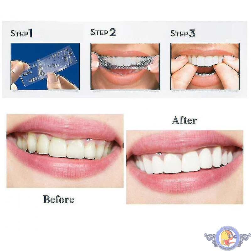 چسب سفید کننده دندان کرست Crest 3D Whitestrips — تصویر ۸