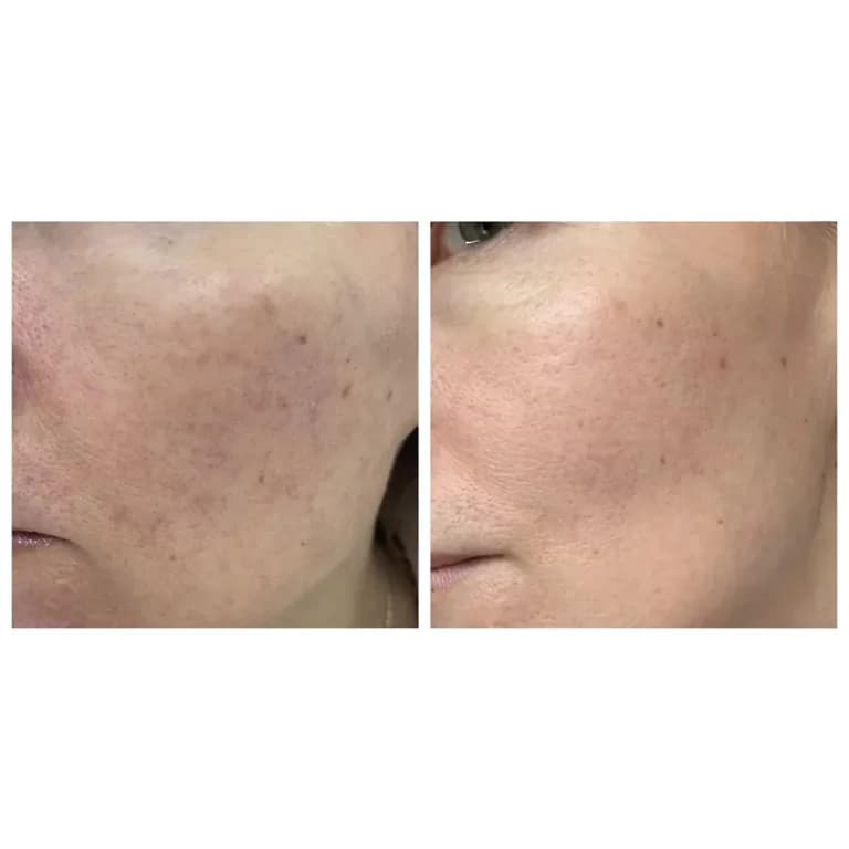 سرم آمپول ضد لک و روشن کننده سنتلا اسکین 1004 اصل SKIN1004 Madagascar Centella Ampoule — تصویر ۱۲