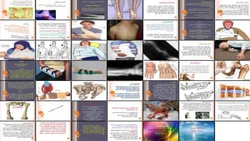 دانلود پروژه بررسی شکستگیهای استخوان تعریف انواع علائم و اصول کمکهای اولیه