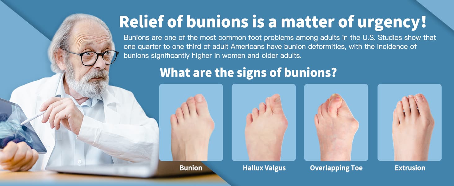 آتل اصلاح کننده بونیون شیائومی مدل Xiaomi Tech Love Bunion Corrector TJ608 — تصویر ۱۱