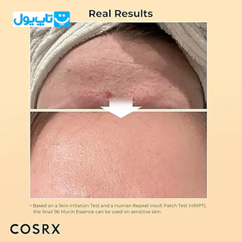 سرم موسین کوزارکس cosrx مدل حلزون حجم 100 میلی لیتر — تصویر ۷