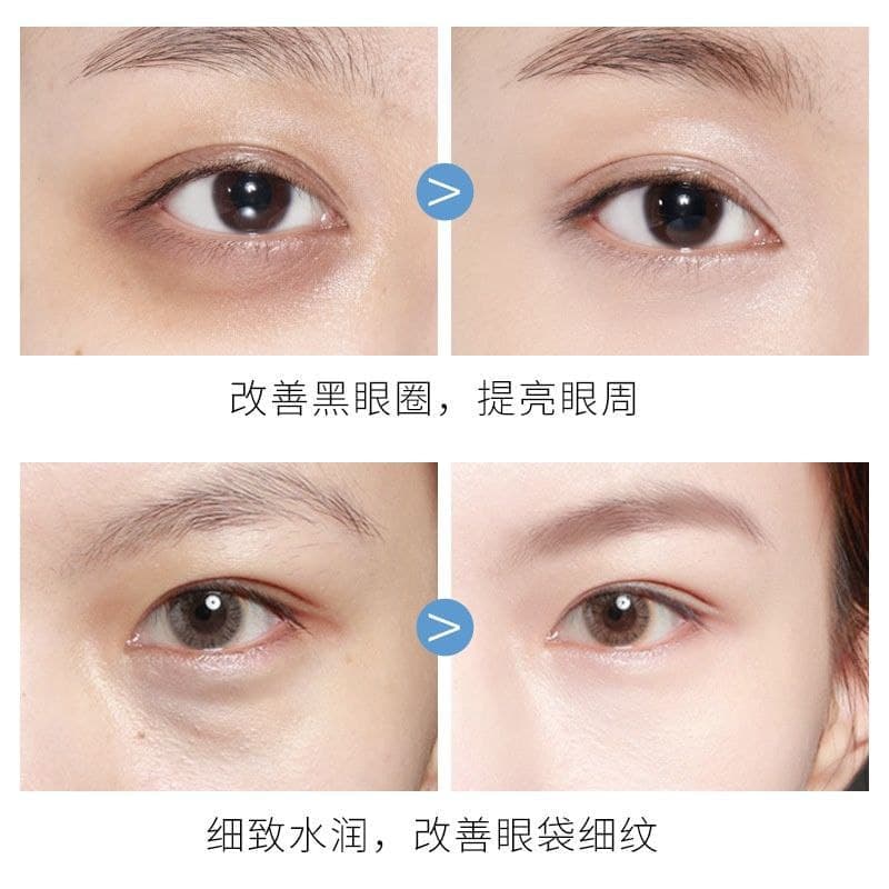 ماسک زیر چشم طلا کلاژن ساز کیس بیوتی KISS BEAUTY 99% 24K Gold Collagen Anti-Aging Soothing Repairing Eye Mask — تصویر ۹