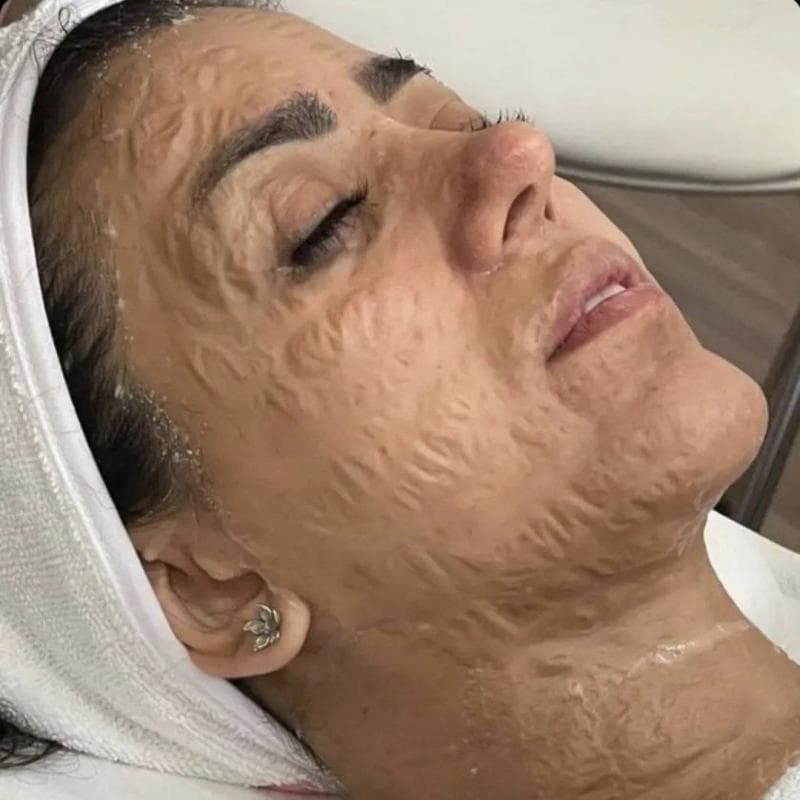 ماسک کانتورینگ پرگاس (PERGAS) — تصویر ۱۲