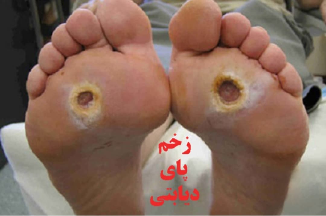 پماد تشنه دارو ( تشنه داری) ۳۰گرمی — تصویر ۱۱