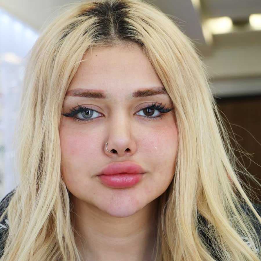 لنز رنگی سلنا طوسی خاکستری دورخفیف هاوایی گری ماهانه — تصویر ۷