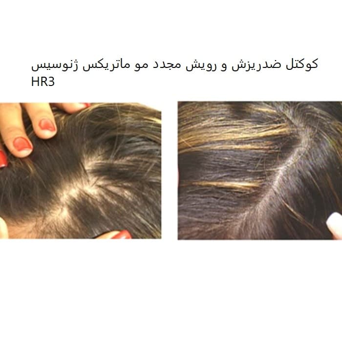 کوکتل تقویت و درمان ریزش مو HR3 ژنوسیس — تصویر ۷