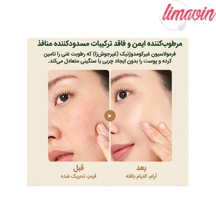 ژل کرم تسکین دهنده جو دوسر پیوریتو حجم 100 میلی لیتر — تصویر ۱۰