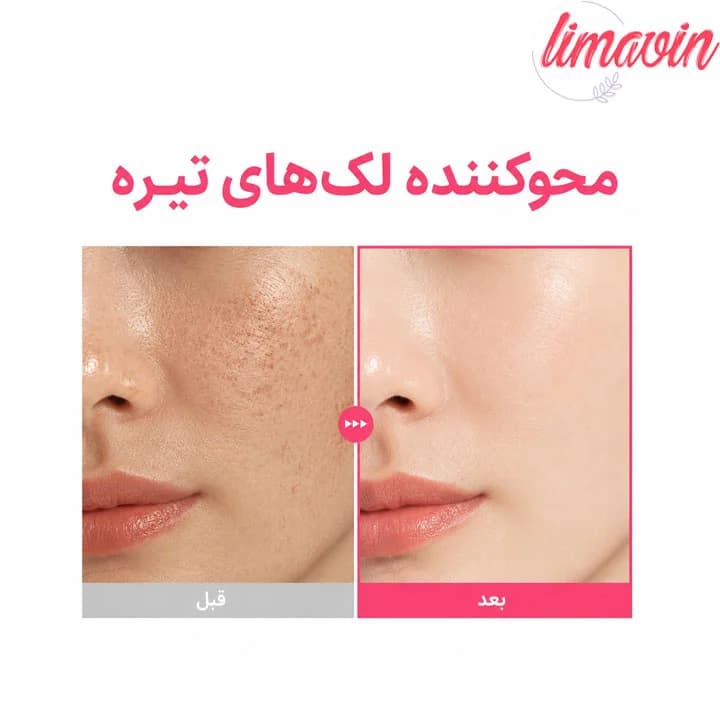 سرم ترانگزامیک اسید 6 نیاسینامید 10 و رتینال پیوریتو حجم 30 میلی لیتر — تصویر ۷
