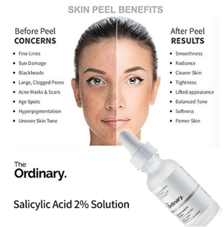 سرم ضد جوش سالیسیلیک اسید 2% سلوشن اوردینری(اصل) The Ordinary Salicylic Acid 2% Solution — تصویر ۶