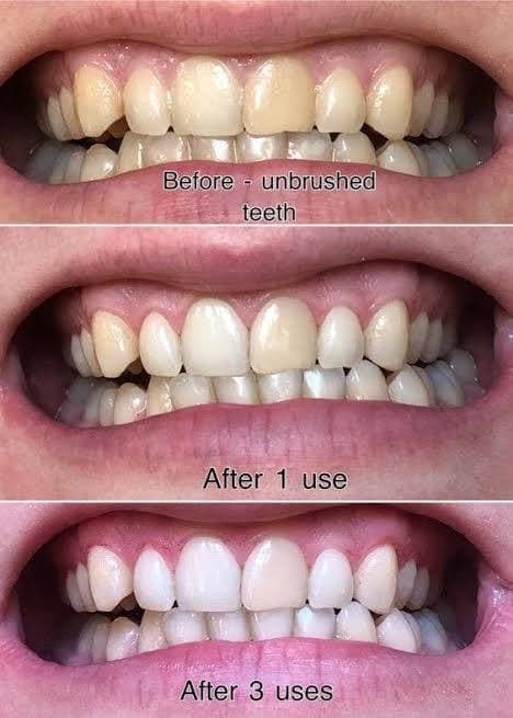 خمیردندان سفید کننده مارویس مدل اسموکر 85 میل Marvis Smokers Whitening Toothpaste Mint — تصویر ۴
