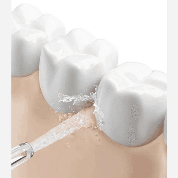 دستگاه شستشوی دهان و دندان واتر جت شیائومی مدل Mijia Water Flosser 2 MEO705 (ارسال رایگان) — تصویر ۶