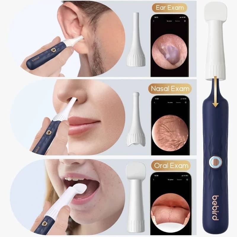 ست کامل گوش پاک کن بیبرد Xiaomi R37R Bebird (ارسال رایگان) — تصویر ۵