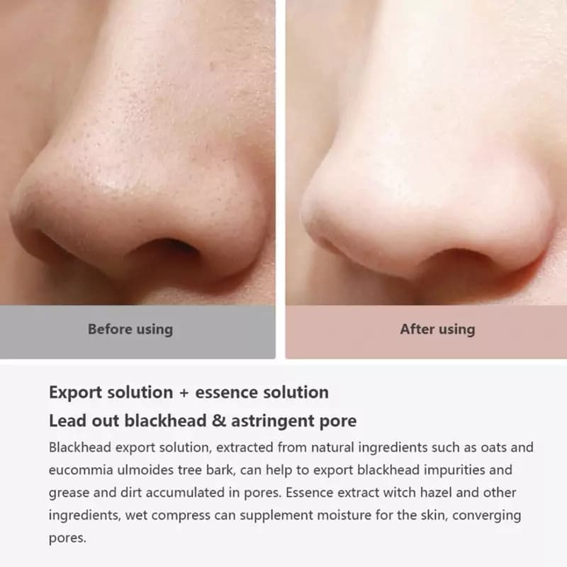دستگاه میکرودرم خانگی و پاک کننده جوش سرسیاه شیائومی Xiaomi Wellskins WX-HT100 Electric Blackhead Cleaner — تصویر ۷