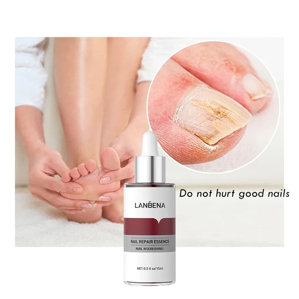 سرم ترمیمکننده ناخن لانبنا مدل Nail Repair Essence حجم 15 میل — تصویر ۴