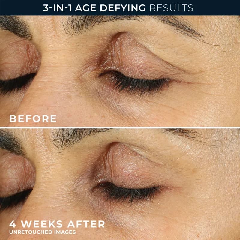 کرم دور چشم رتینول راک RoC Retinol — تصویر ۶