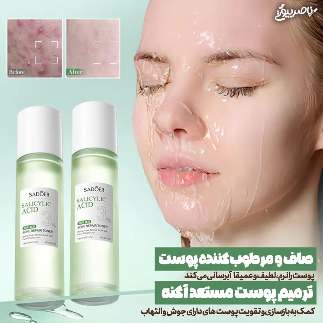 تونر سالیسیلیک اسید 3 درصد سادور کنترل چربی و جوش — تصویر ۵